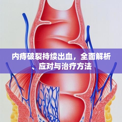 內(nèi)痔破裂持續(xù)出血，全面解析、應對與治療方法