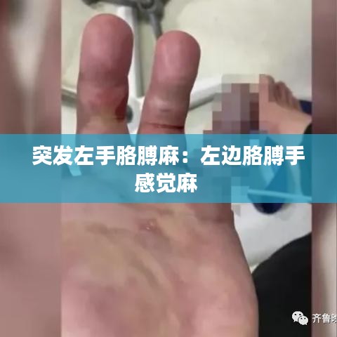 突發(fā)左手胳膊麻：左邊胳膊手感覺(jué)麻 