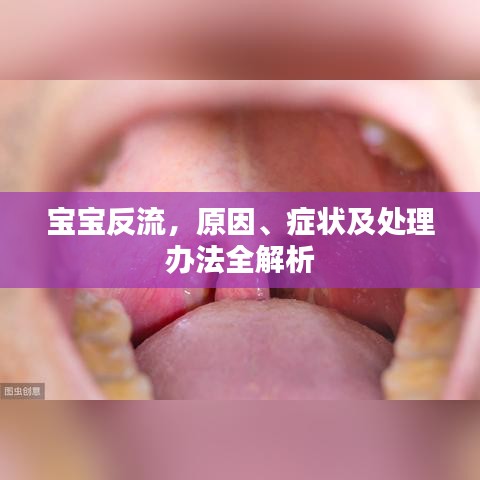 寶寶反流，原因、癥狀及處理辦法全解析