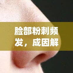 臉部粉刺頻發(fā)，成因解析與防治管理策略