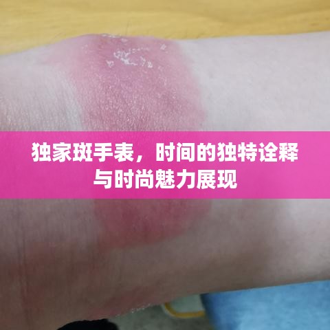 獨家斑手表，時間的獨特詮釋與時尚魅力展現(xiàn)